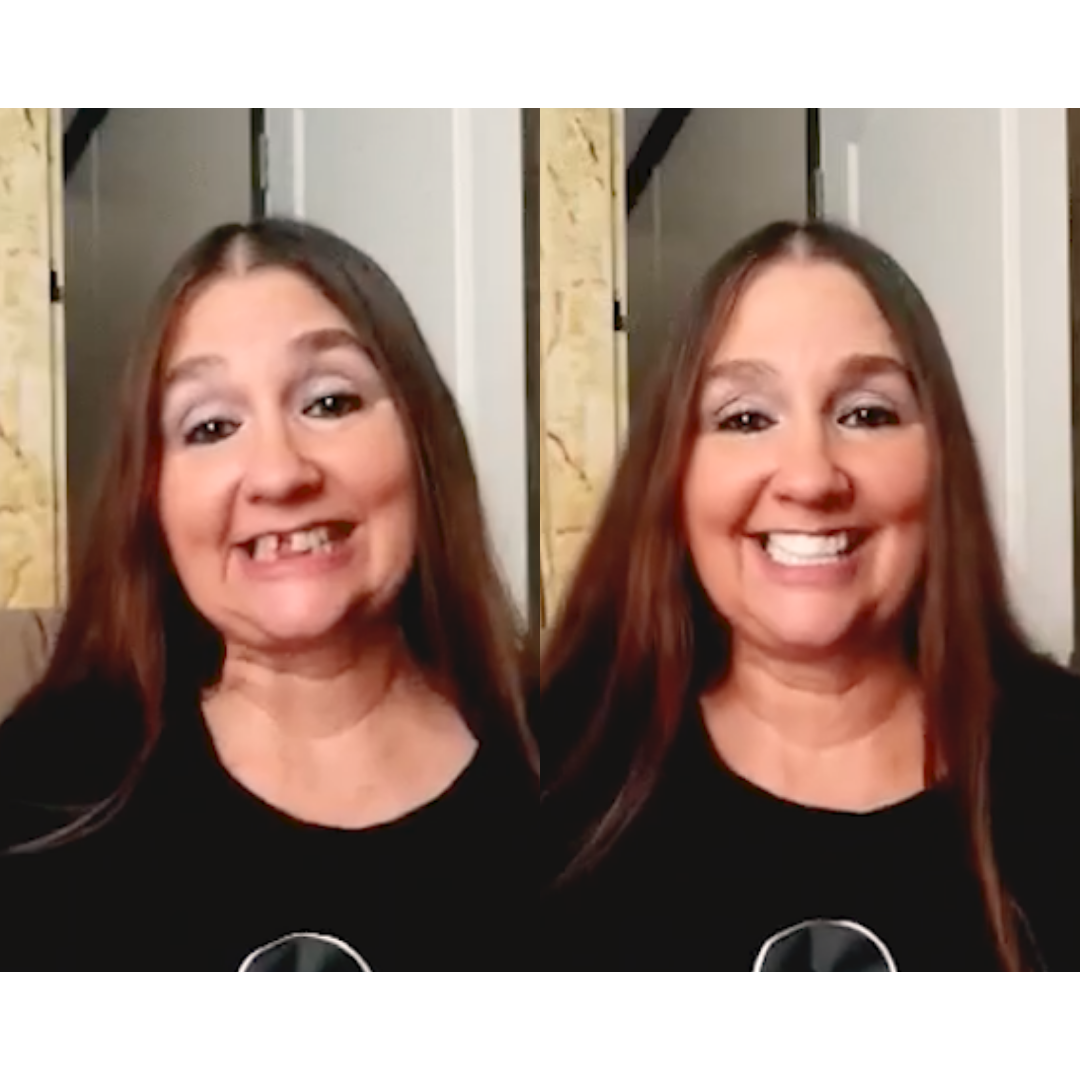 Evolution of my smile!