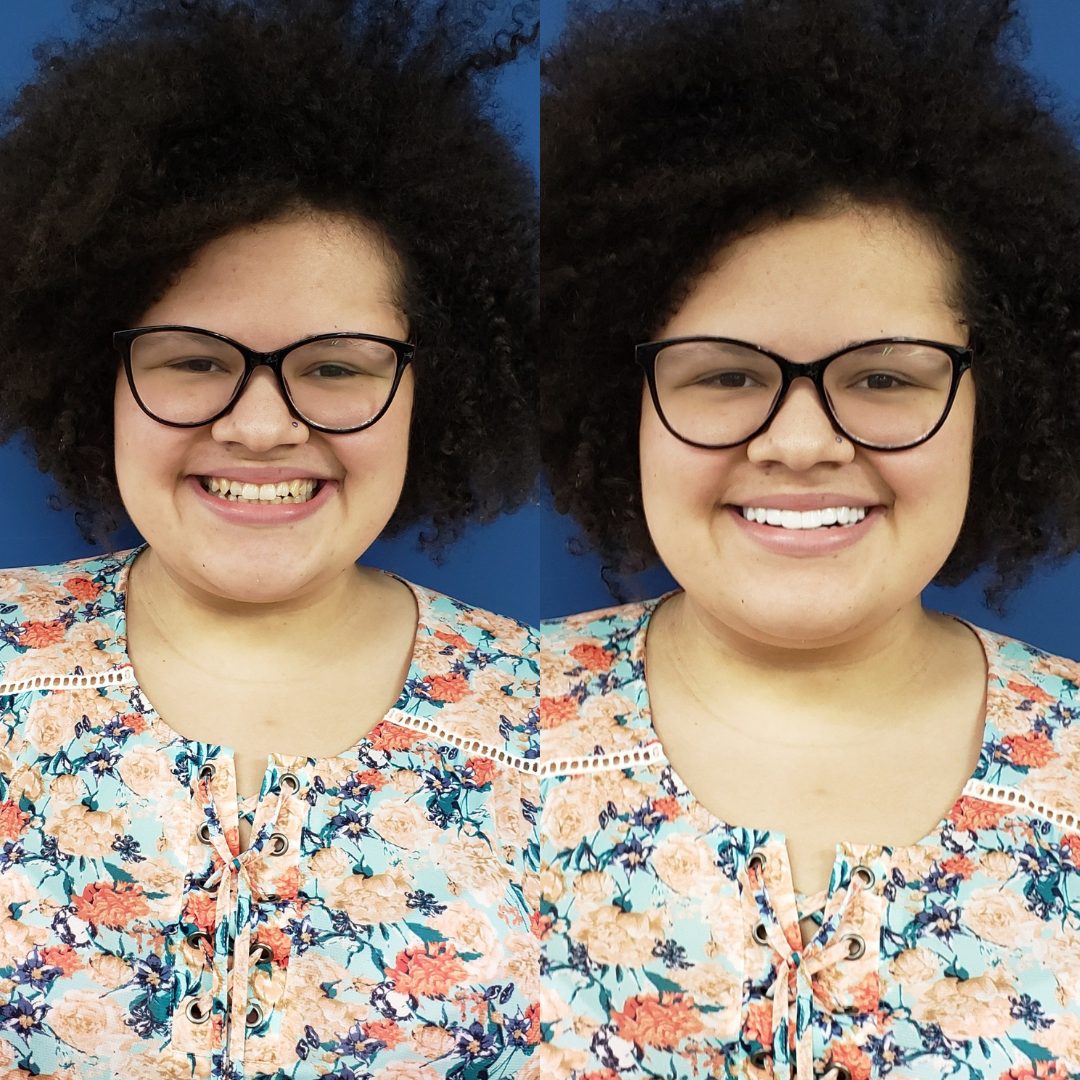 Beautiful Bright Smile