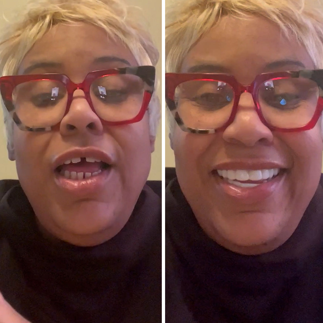 Get the smile you’ve always wanted