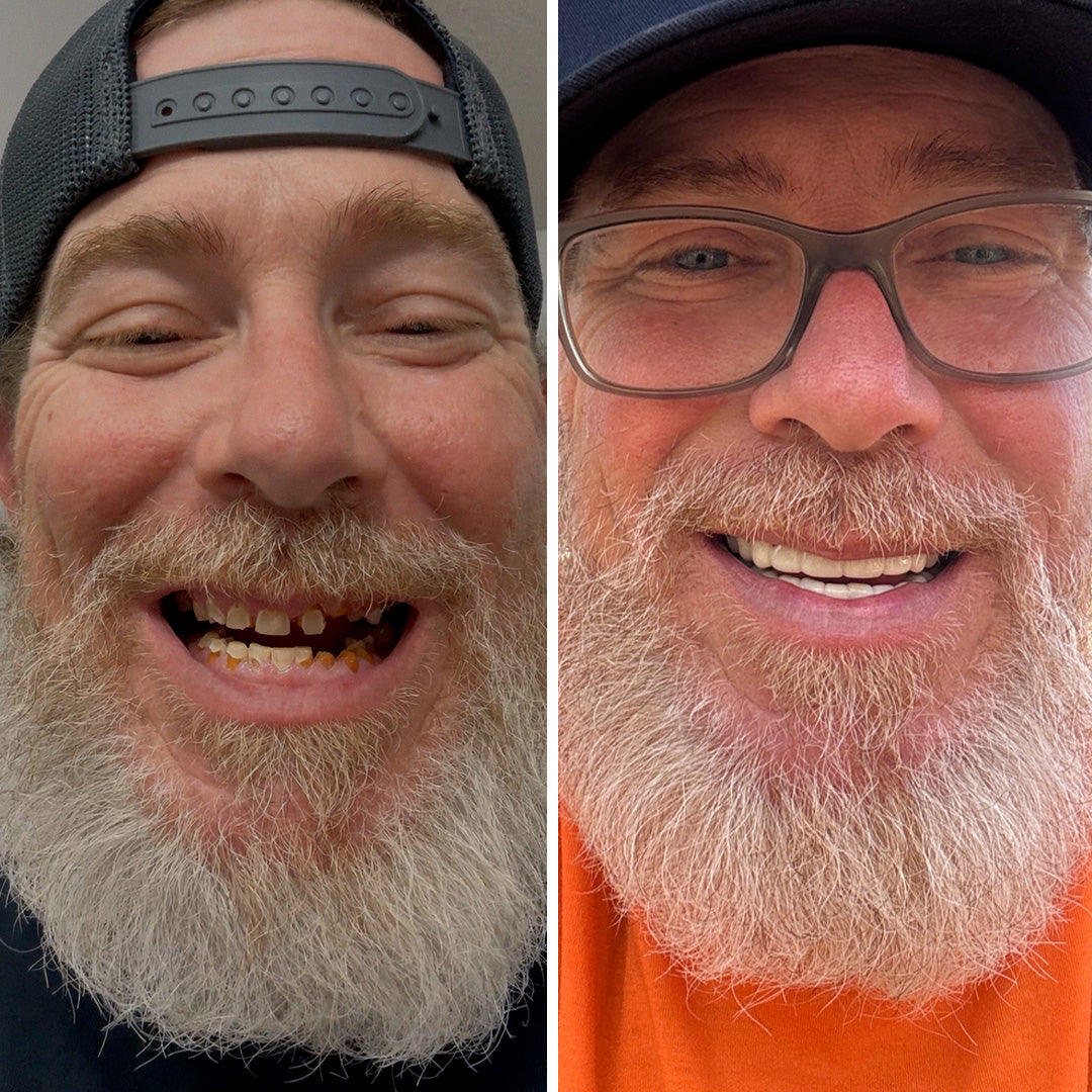 You can’t imagine the confidence boost!