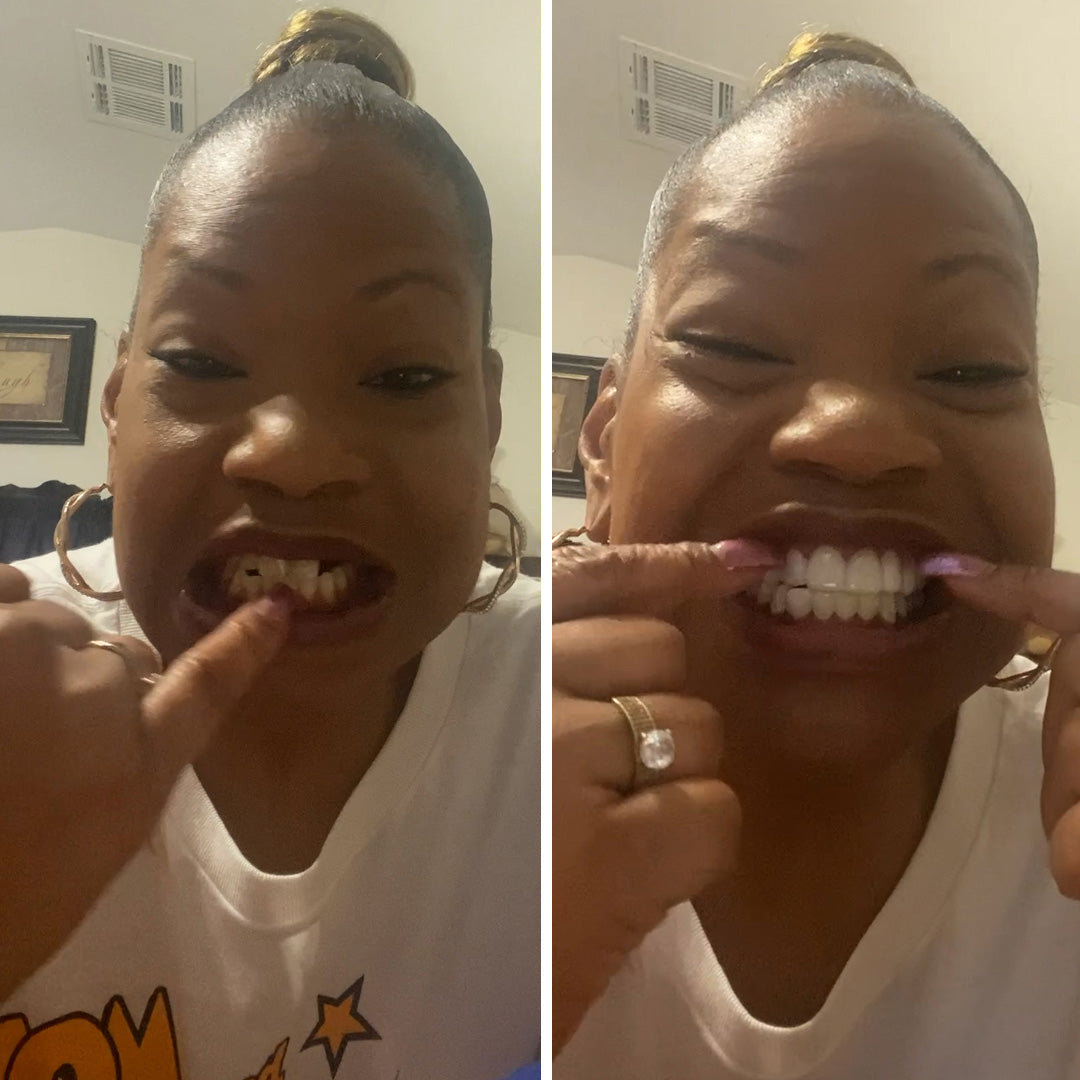 Game changing smile!