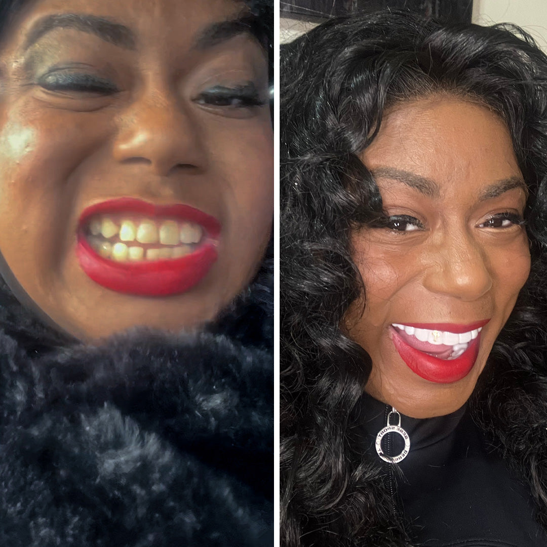 I love to smile with Pop On!