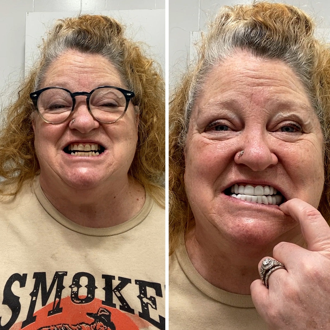 Beautiful smile after 34 years