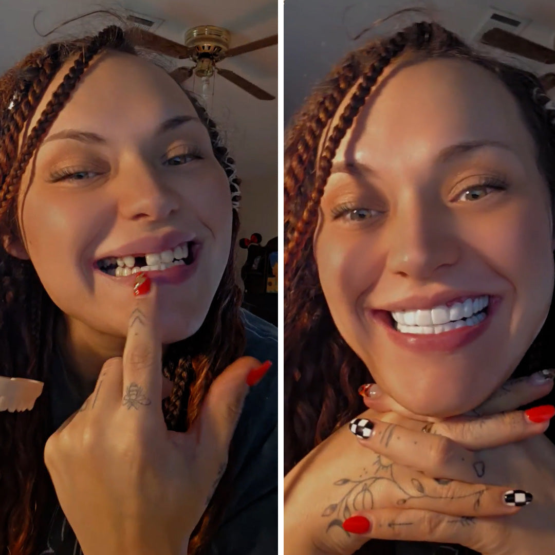 No more missing teeth!