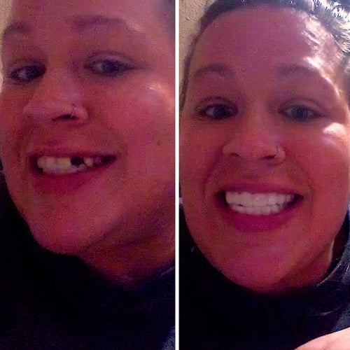 It’s amazing to smile again!