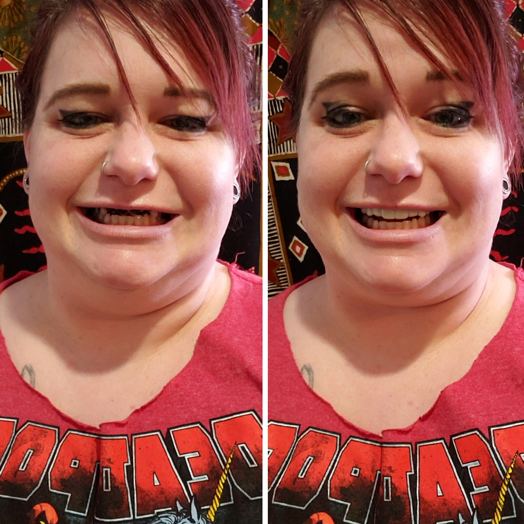 Finally able to smile again