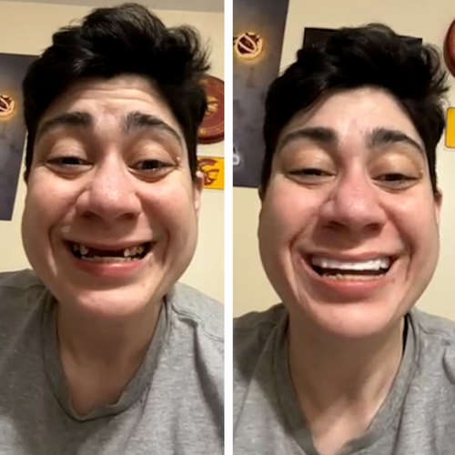 Smiling again thanks to Pop On!