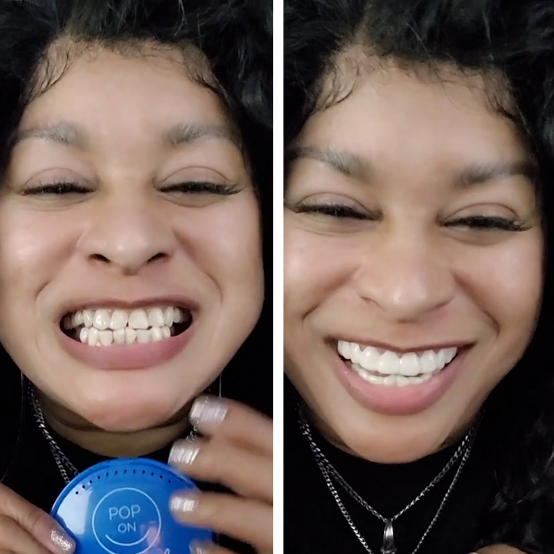 I am SO happy with Pop On Veneers!