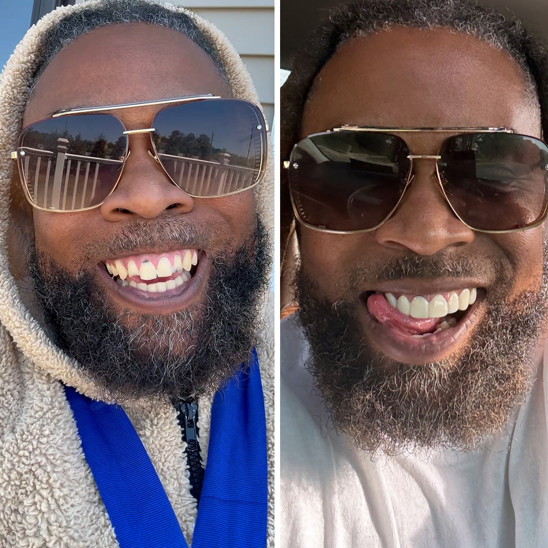 If you’re tired of your teeth, buy some new ones!