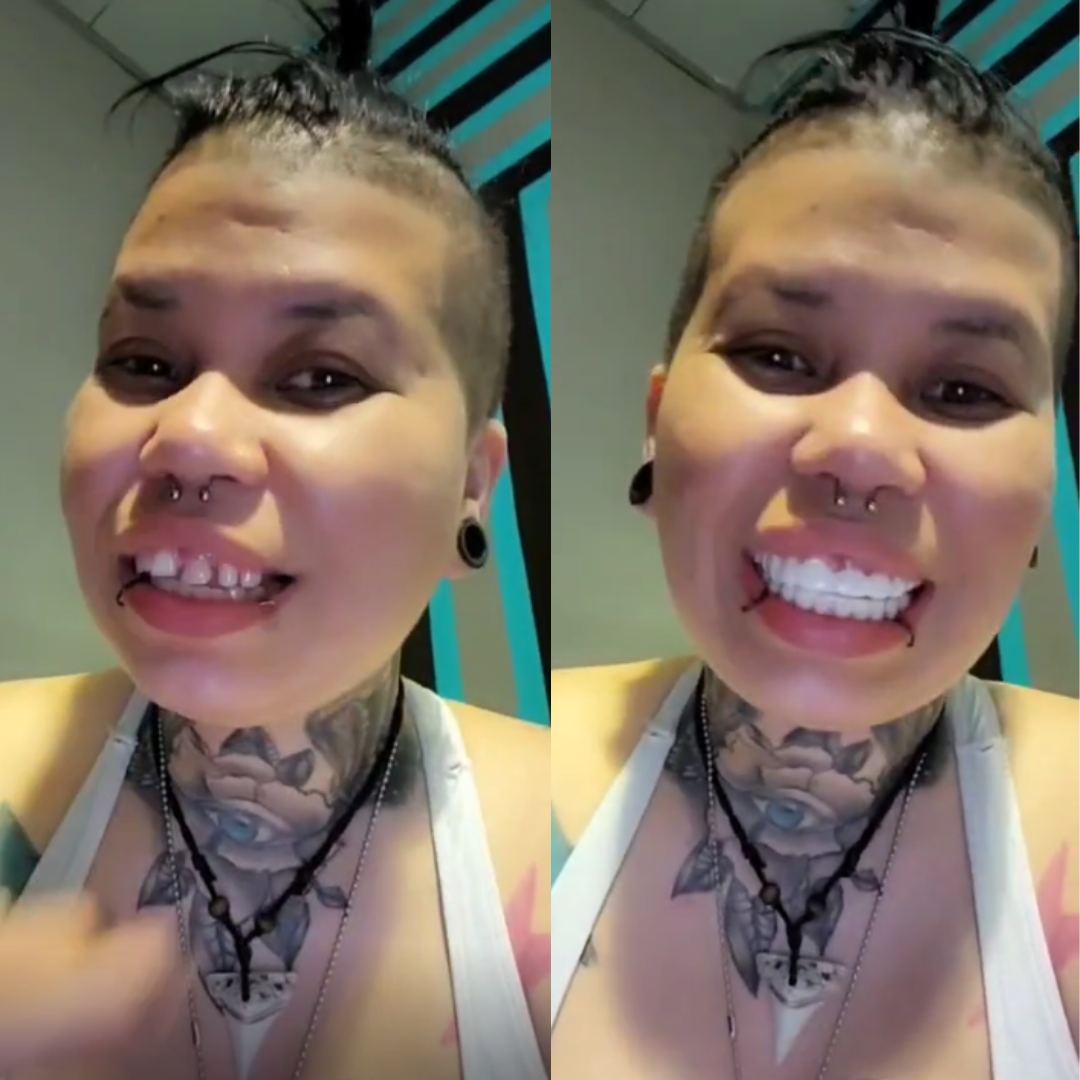 Just snap literally on your teeth