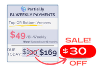 Bi-Weekly Payment Plan - Pop On Veneers with At Home Impression Kit - $30 Off