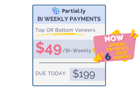 Bi-Weekly Payment Plan - Pop On Veneers with At Home Impression Kit