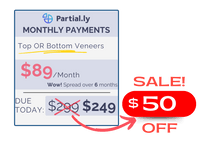 Monthly Payment Plan - Pop On Veneers with At Home Impression Kit - $50 Off