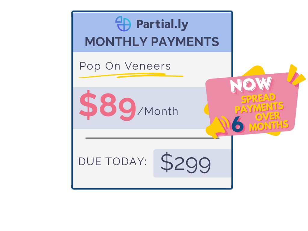 Monthly Payment Plan - Pop On Veneers with At Home Impression Kit