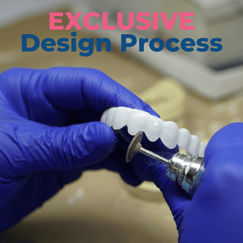 Add Opposite Arch After Veneers Delivered