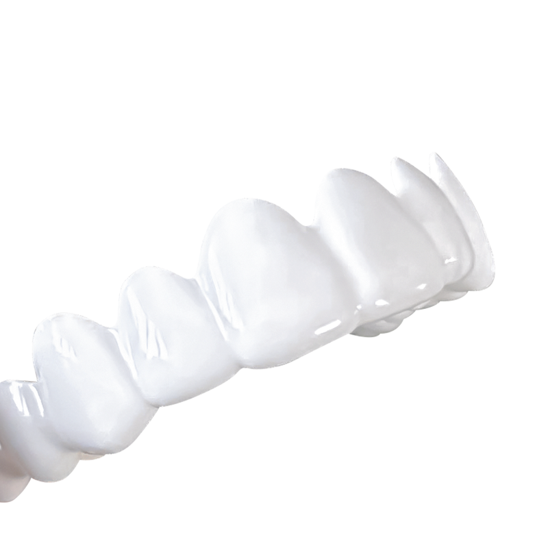 Pop On Veneers for Friends & Family with Impression Kit