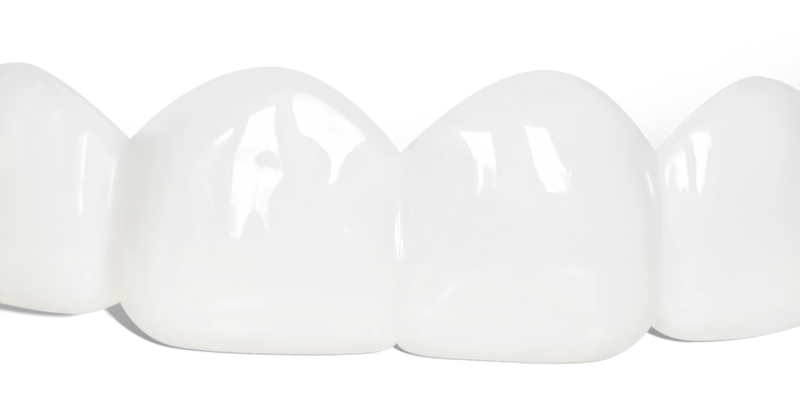 Pop On Veneers for Friends & Family with Impression Kit