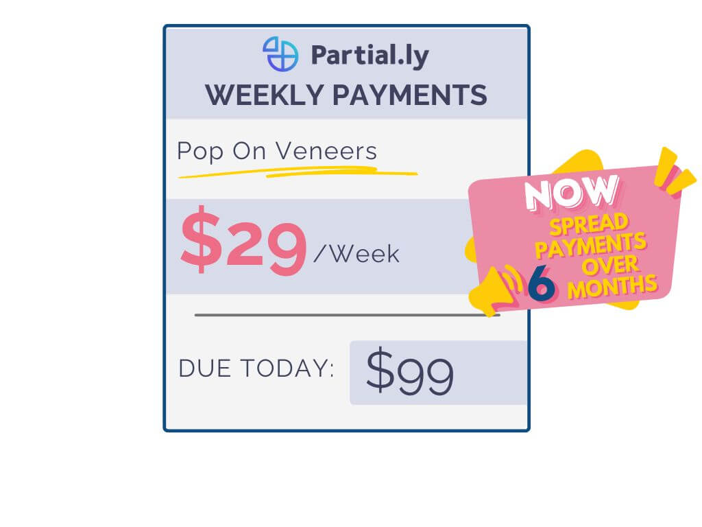 Payment Plan - Pop On Veneers - With At Home Impression Kit