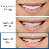 Reward 4 | Spare Veneer | Single Arch + Ultra Clean Bundle - ($208 Value)