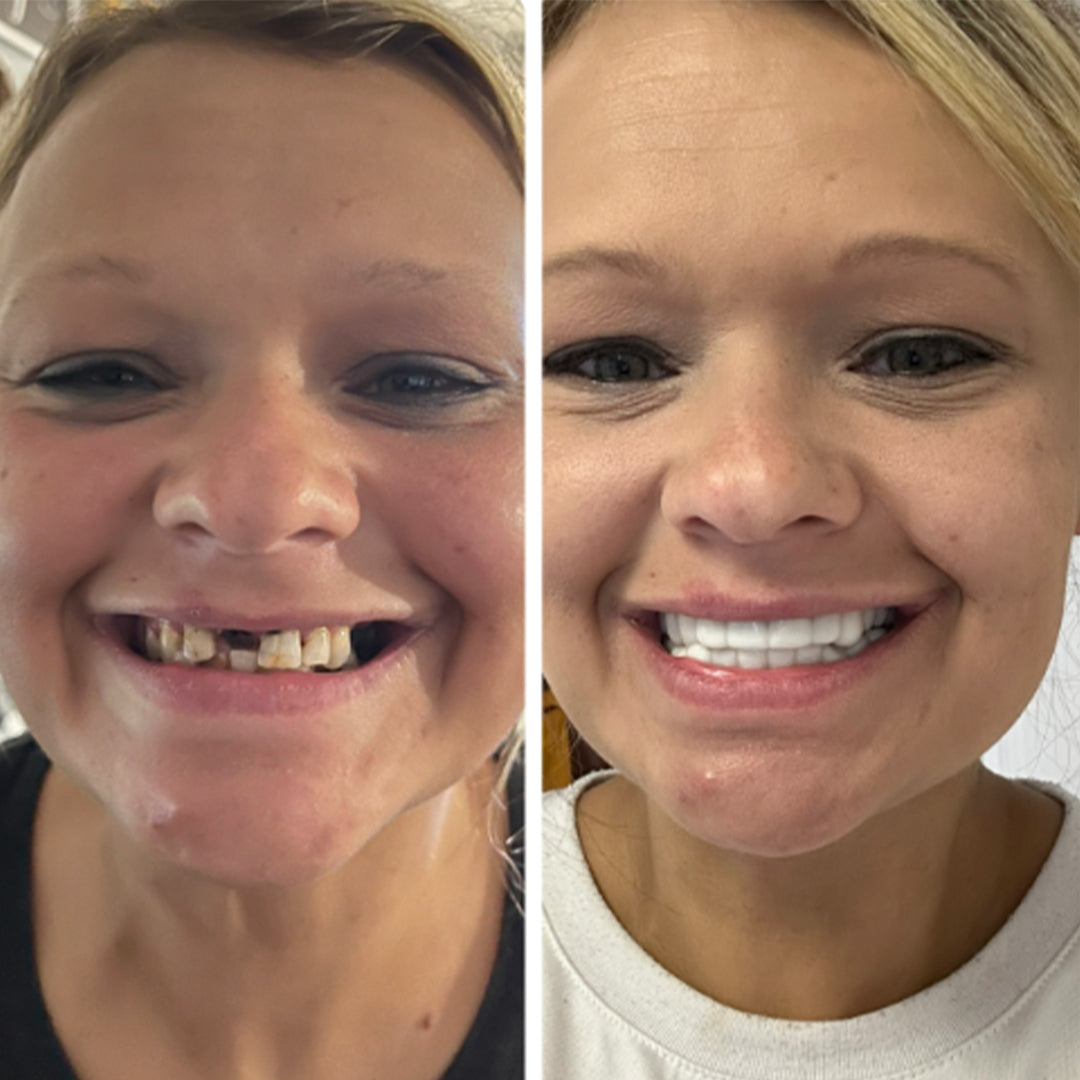 Ready for an affordable smile solution?