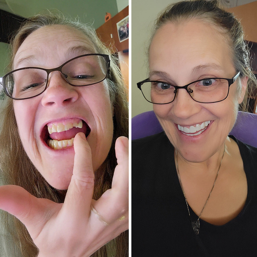 Absolutely love my smile