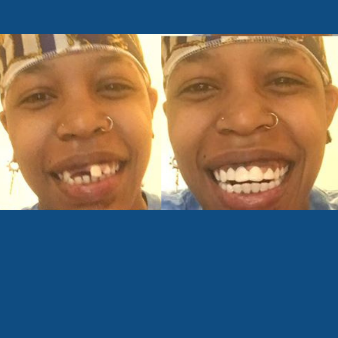 Now I'm smiling with confidence