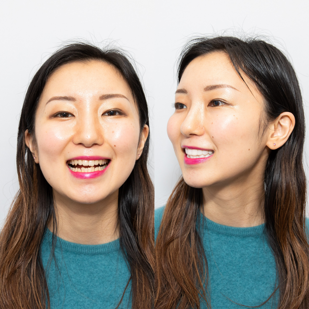 Nothing will stop me now