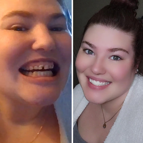 I’ve taken so many selfies!