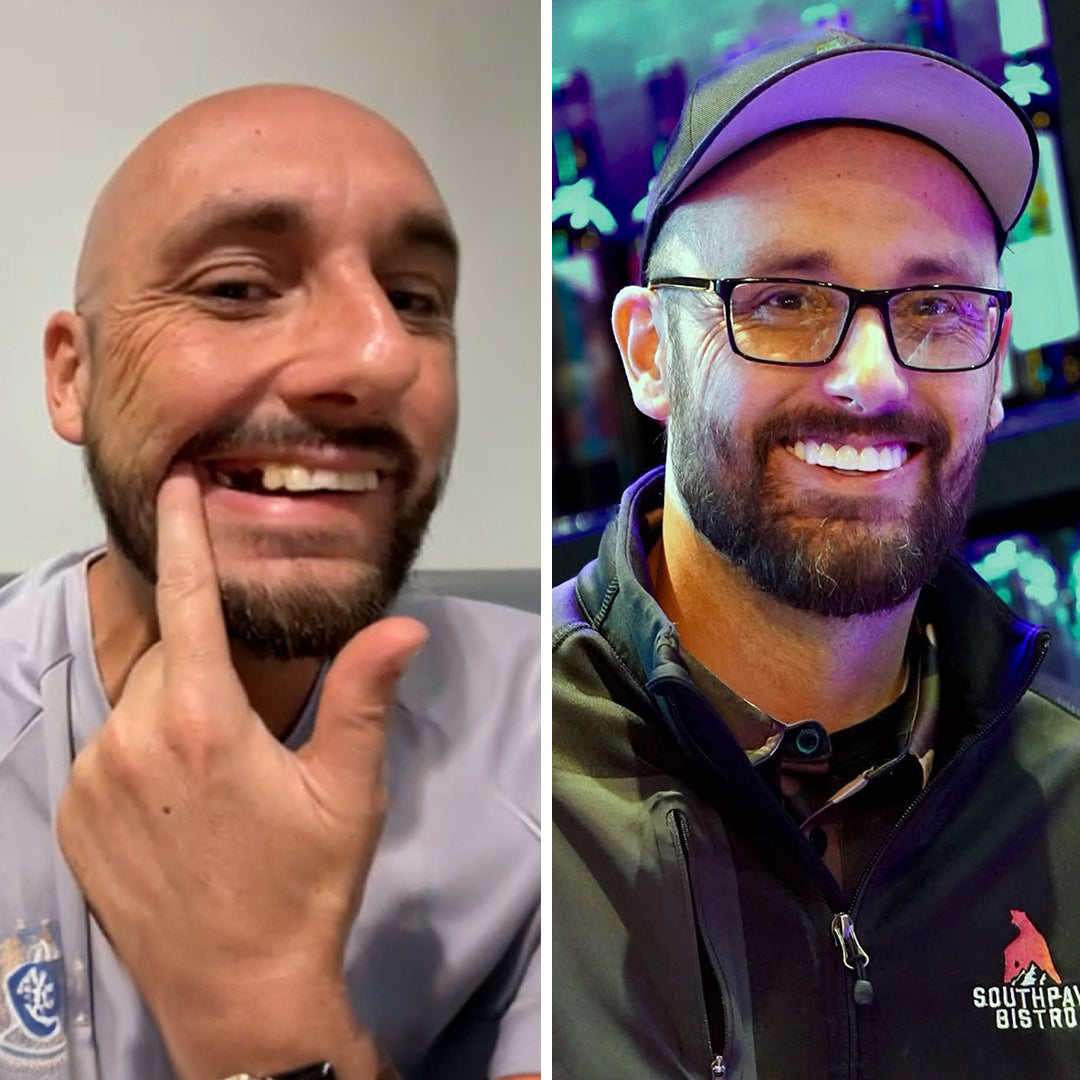 Super happy with my new smile