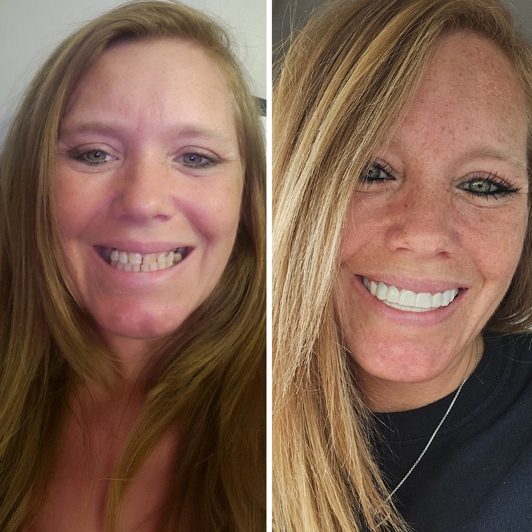 It’s so easy to smile again!