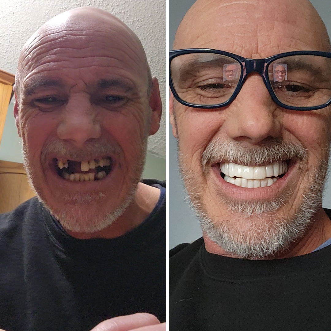 So impressed with my smile!