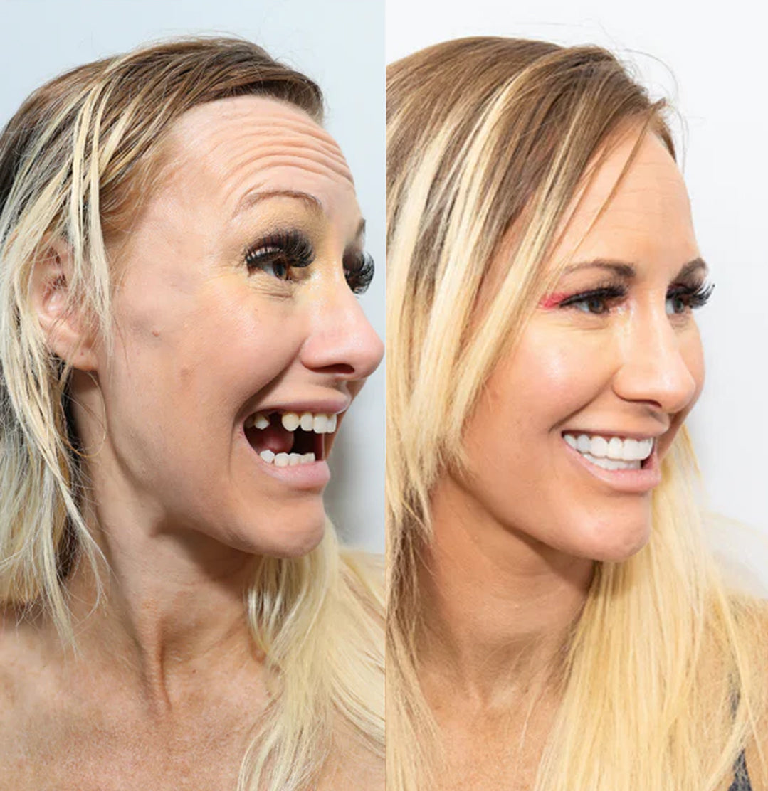 Smile Transformation Success!