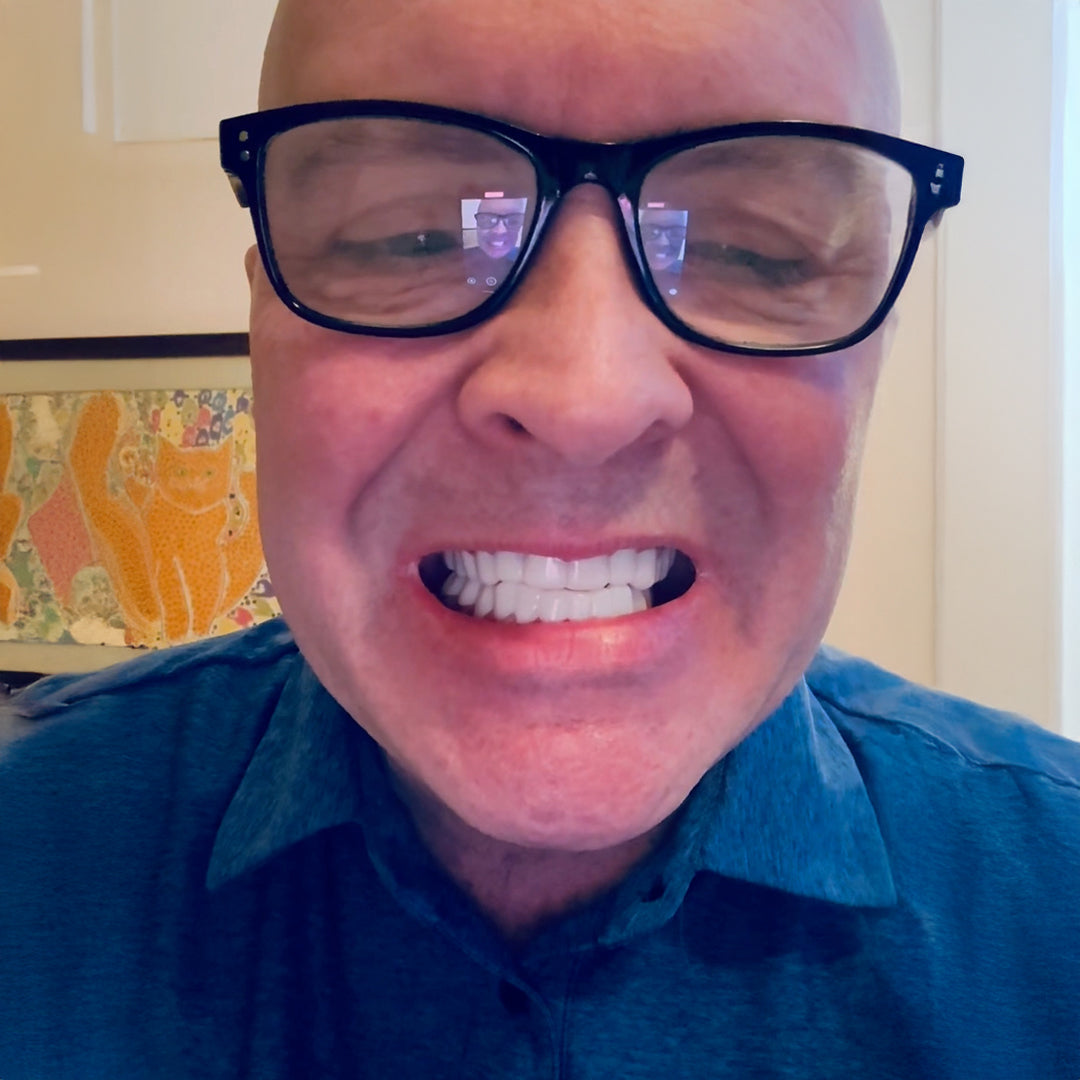 My Pop On Veneers are perfect!