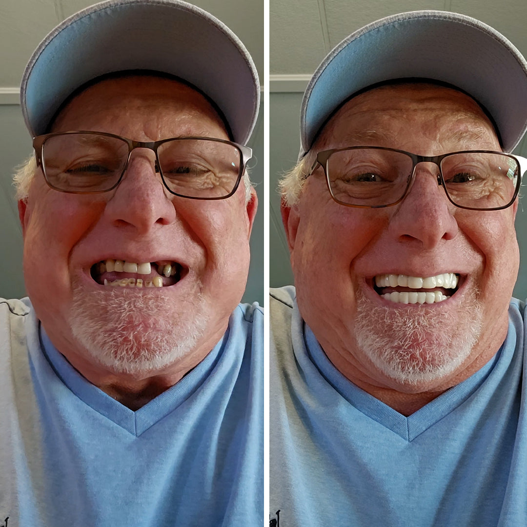 Complete smile transformation!