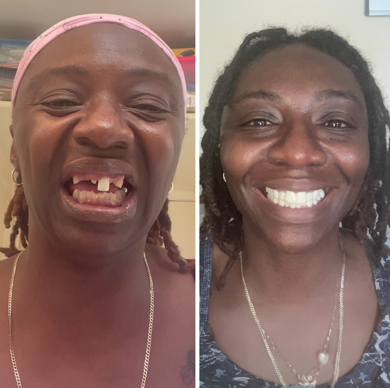 Got my confidence and my smile back!