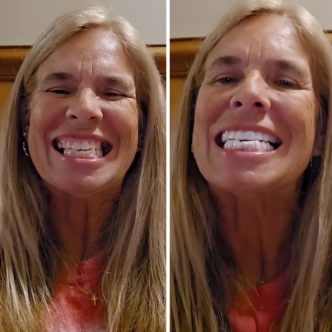 Easy, affordable smile upgrade!