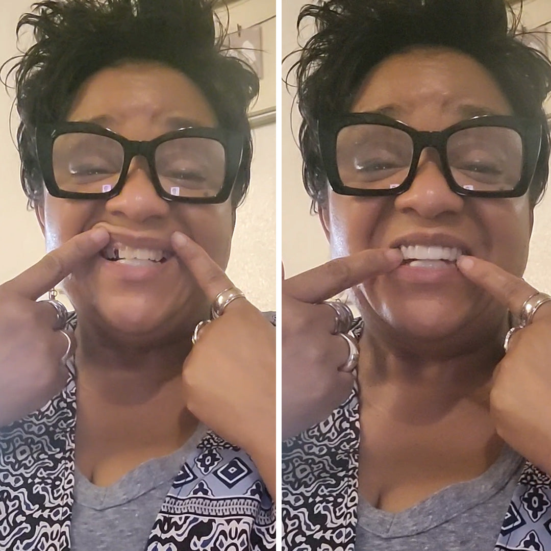 Still loving my smile 4 years later