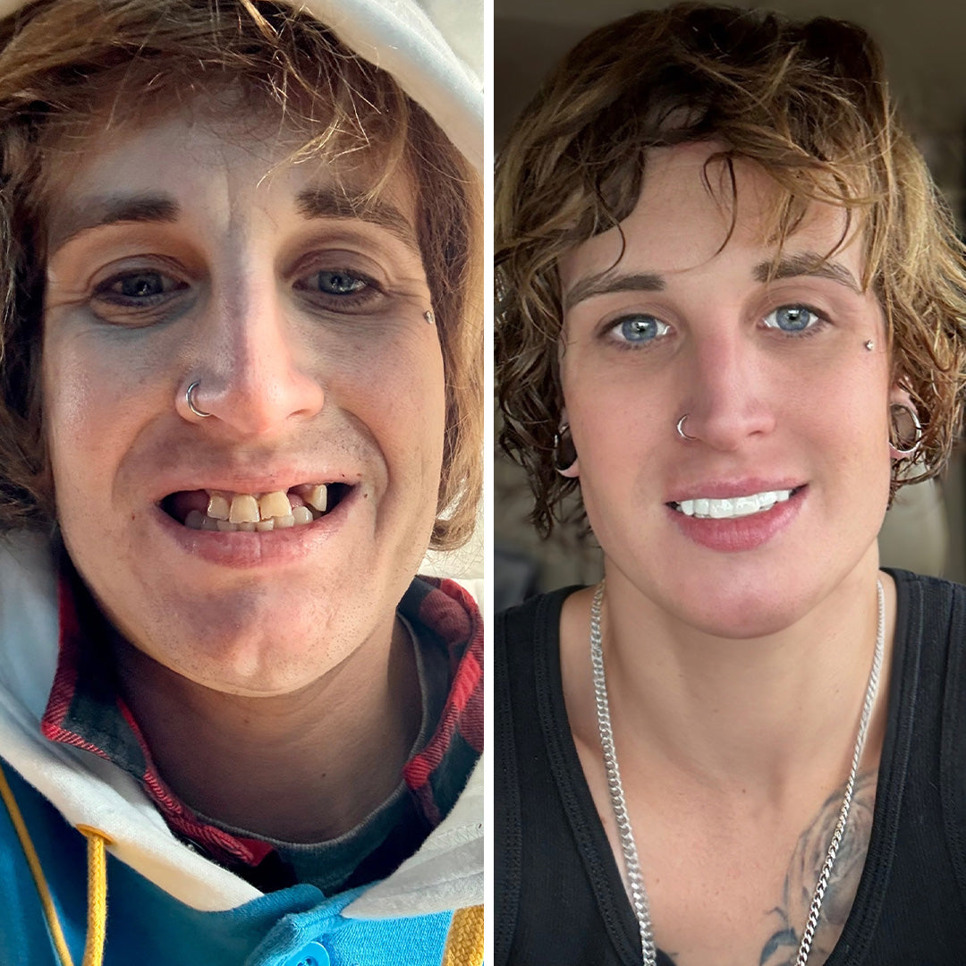 Super happy with the results!