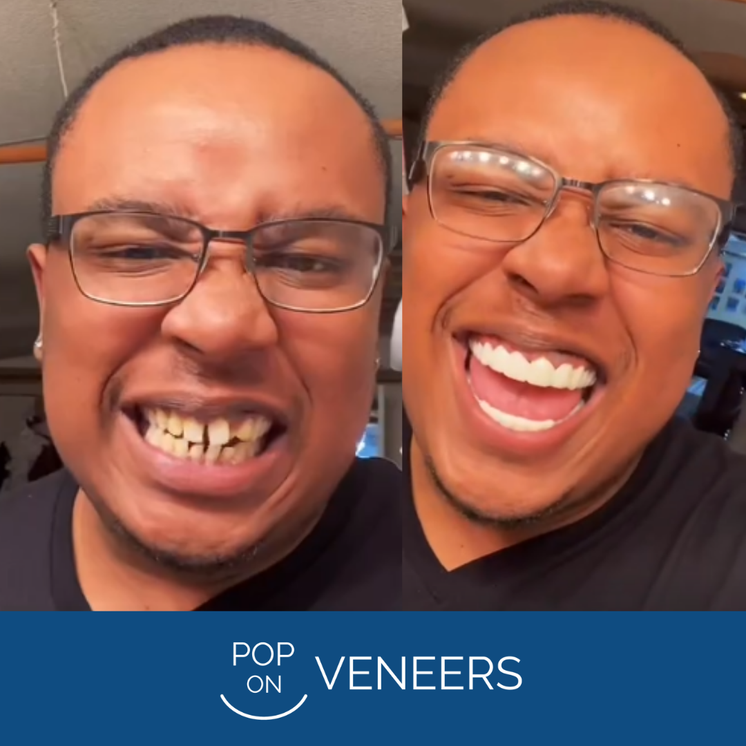 Pop On Veneers saved my life!