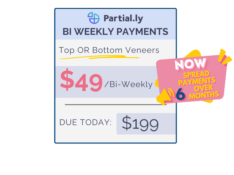 Bi-Weekly Payment Plan - Pop On Veneers with At Home Impression Kit