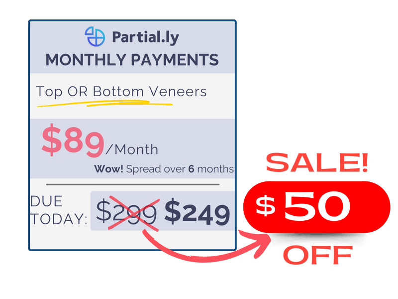 Monthly Payment Plan - Pop On Veneers with At Home Impression Kit - $50 Off