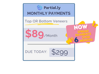 Monthly Payment Plan - Pop On Veneers with At Home Impression Kit