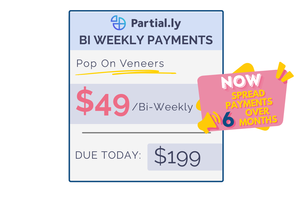 Bi-Weekly Payment Plan - Pop On Veneers with At Home Impression Kit