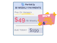 Bi-Weekly Payment Plan - Pop On Veneers with At Home Impression Kit
