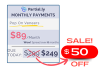 Monthly Payment Plan - Pop On Veneers with At Home Impression Kit - $50 Off
