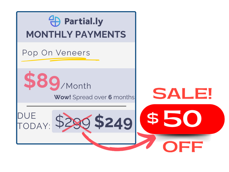 Monthly Payment Plan - Pop On Veneers with At Home Impression Kit - $50 Off