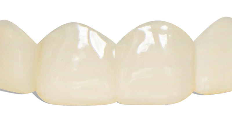 Pop On Veneers for Friends & Family with Impression Kit