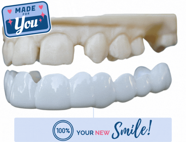 Veneers and model gif forreplo website (1).gif