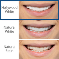 Reward 4 | Spare Veneer | Single Arch + Ultra Clean Bundle - ($208 Value)